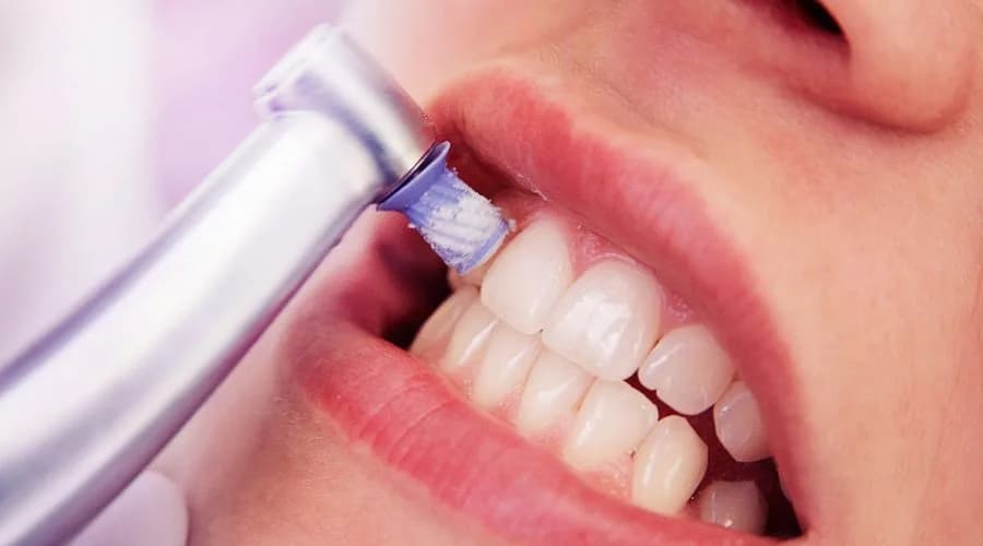 Professionelle Zahnreinigung durch Dentalhygienikerin